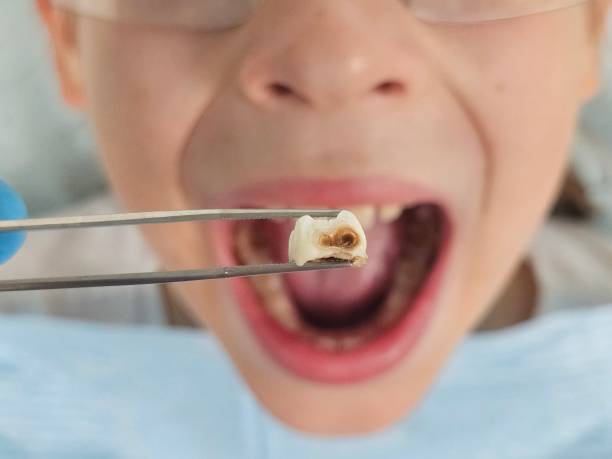 Best Weekend Emergency Dentist in Orleans, VT